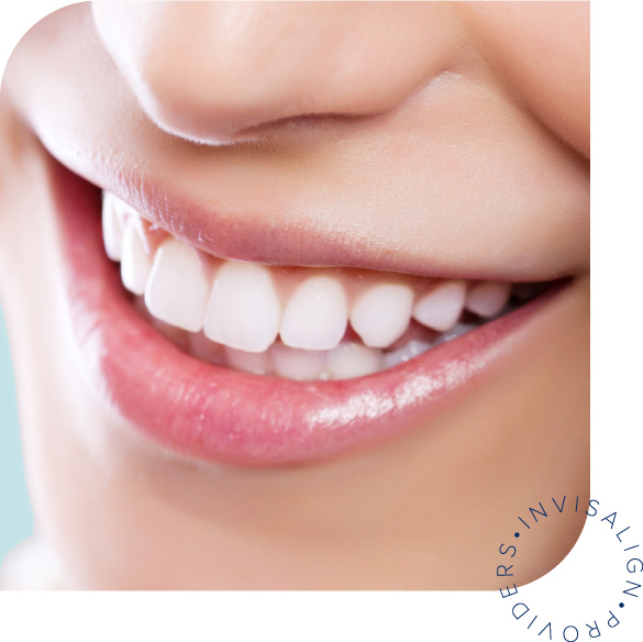 Invisalign folije za ispravljanje zuba