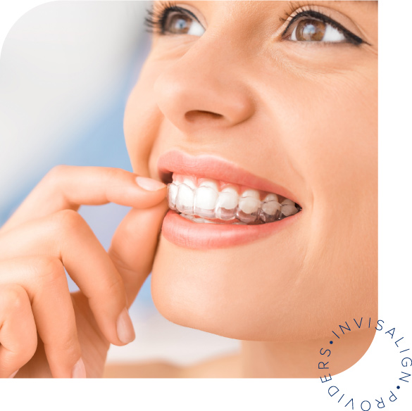 Invisalign folije za ispravljanje zuba